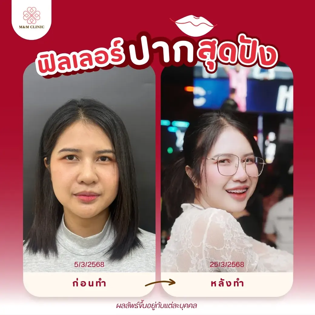 rev-face-shape-00006